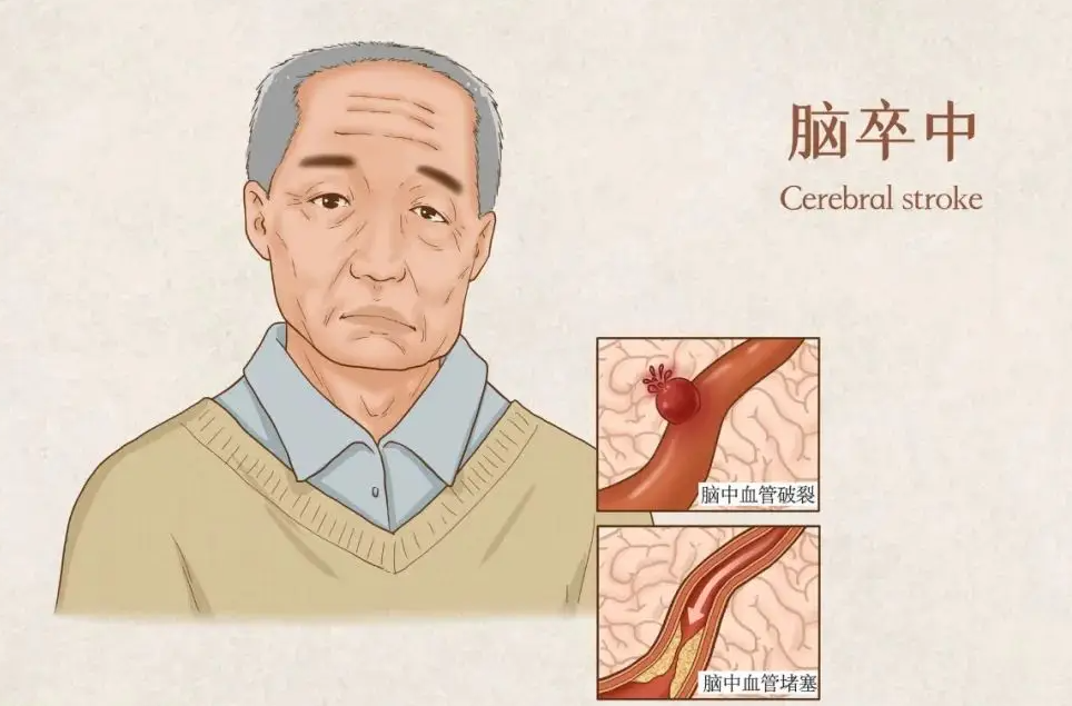 最新研究发现：本地学生学业表现影响因素分析