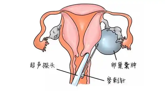 QQ快餐大学生：当00后把校园活成一场大型真人养成游戏