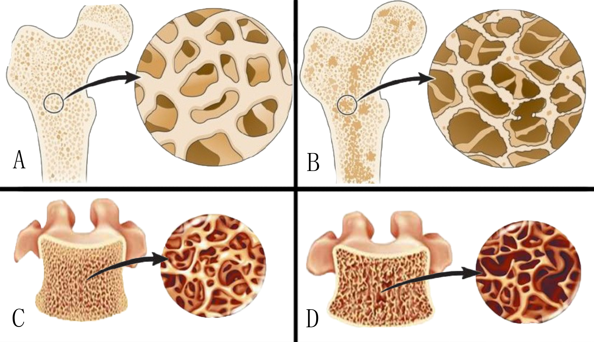 补钙食物排行榜 真正补钙冠军是谁