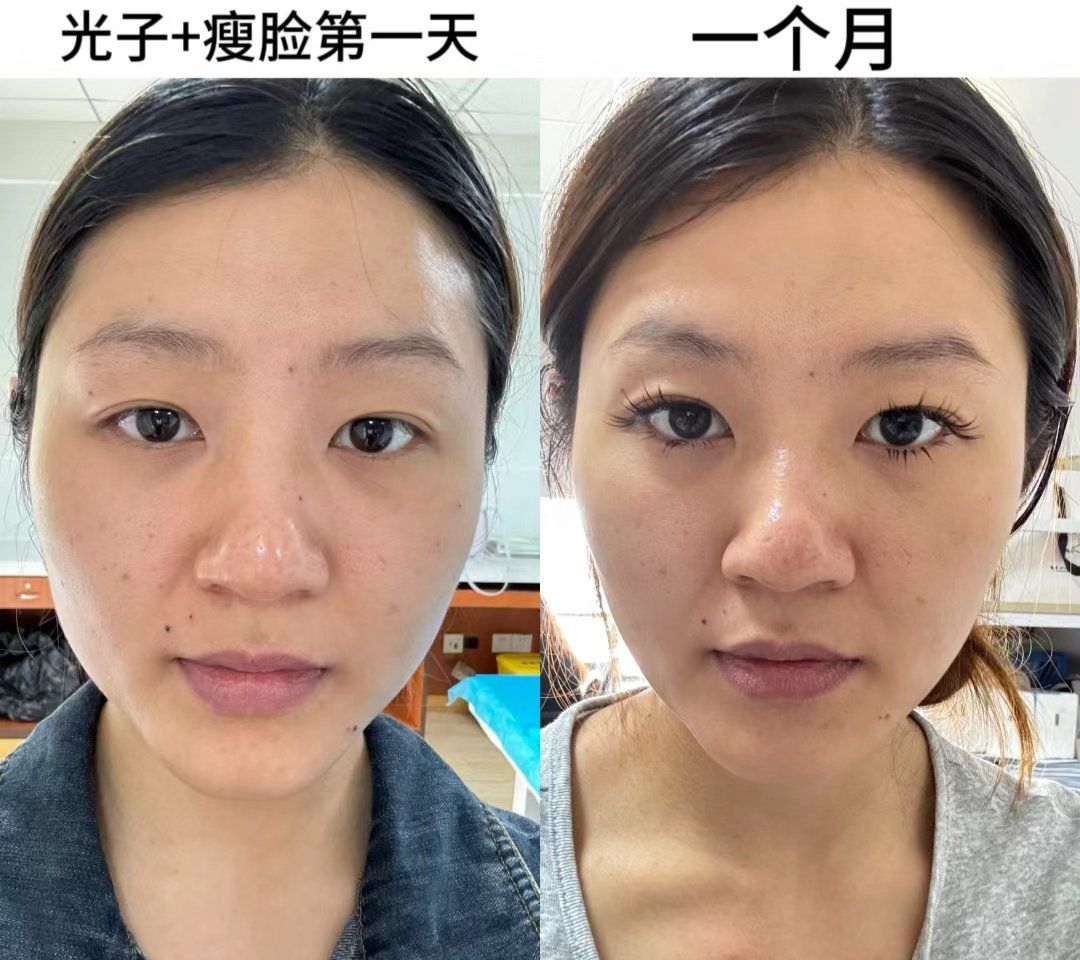 漳州女大学生的精油按摩体验与护理建议全解析